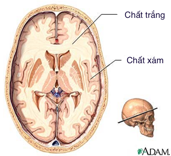 tranhongvan chatxamchattrang mh0