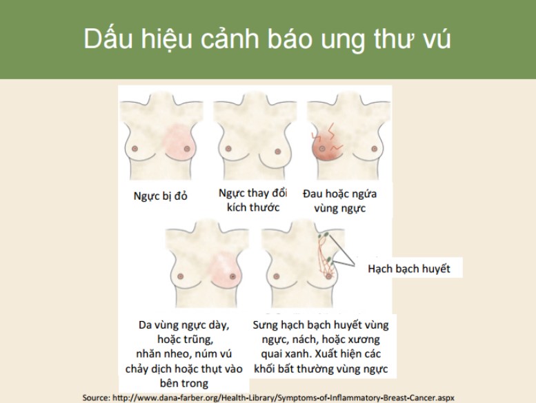 ungthu3