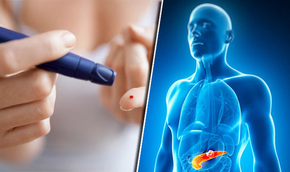 Diabetes symptoms 870995