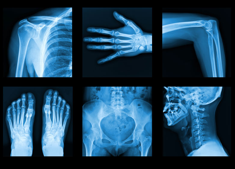 x ray