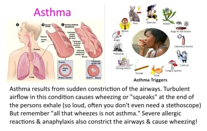 asthma 1